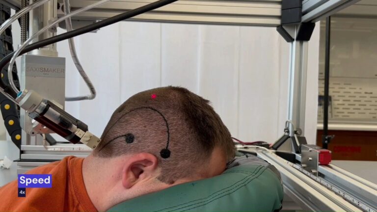 tatuagem-eletronica-temporaria-pode-revolucionar-os-exames-cerebrais