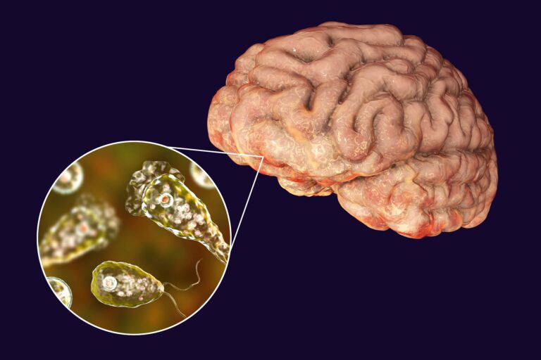 ceara-investiga-morte-de-crianca-por-ameba-‘comedora-de-cerebro’