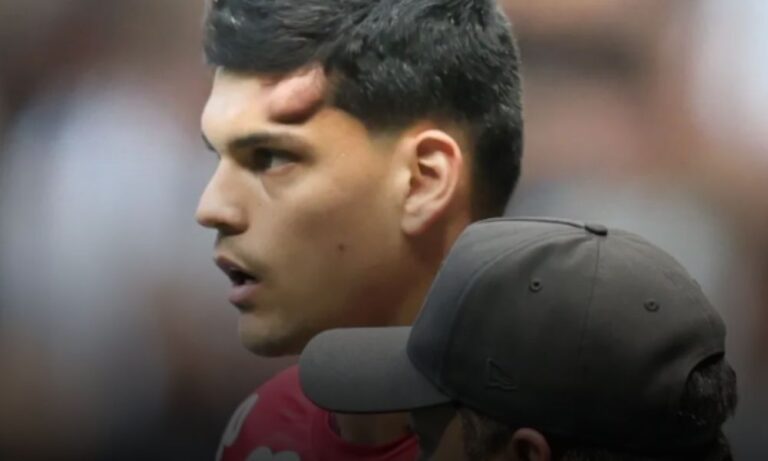 cbf-aciona-protocolo-de-concussao-cerebral-e-brazao-devera-desfalcar-santos-contra-o-sao-paulo